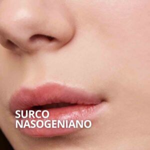 relleno surco nasogeniano Sevilla