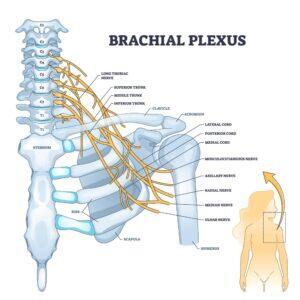 Brachial Plexus Injury