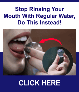 renew dental support