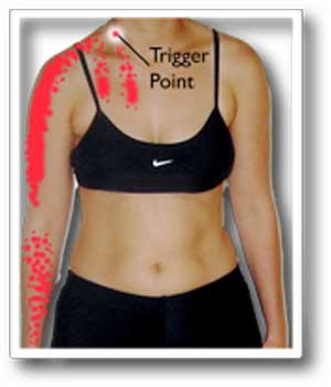 Лестничные мышцы