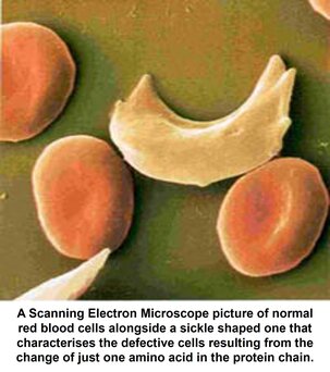 Scanning Electron Microscope of normal red blood cells