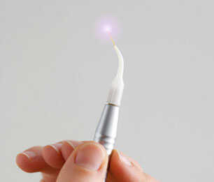 Air abrasion allows precise tooth treatment with no drilling
