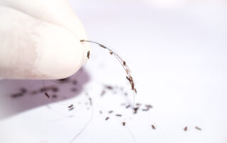 nits on a hair strand