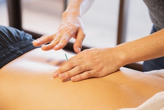 Acupuncture, stress management, Chronic Pain relief