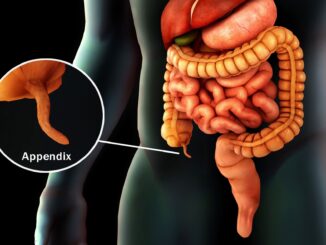 Tiny Organ, Long-Lasting Pain: Mystery of Chronic Appendicitis