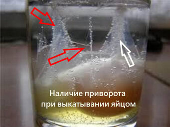 Как снять приворот с мужчины