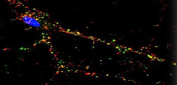 Synapse dysfunction and psychiatric disorders: Suspect gene corrupts neural connections