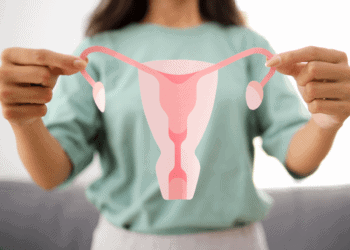 GLP-1 Drugs for PCOS