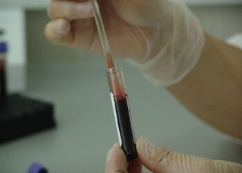 VIH Sida - crainte d'un relance de l' épidémie
