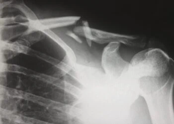 Tibo InShape méchamment blessé