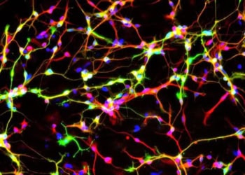 Parkinson’s disease research puts designer dopamine neurons within reach