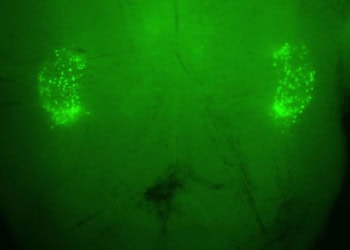 Researchers pinpoint origin of sighing reflex in the brain