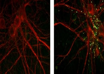 Decrypting a collagen’s role in schizophrenia