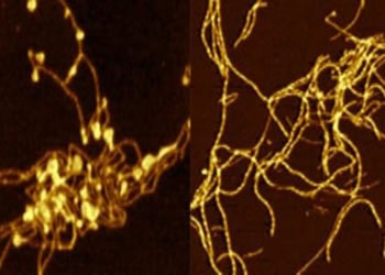 Tiny changes in Parkinson’s protein can have ‘dramatic’ impact on processes behind onset