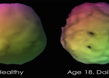 New study shows marijuana users have low blood flow to the brain