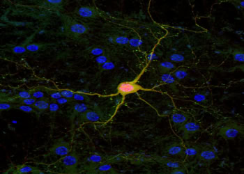 Study shows development of face recognition entails brain tissue growth