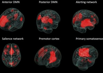 Statistics method shows networks differ in epileptic brains