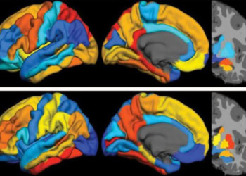 A psychiatrist explains how seeing problems in the brain makes stigma disappear