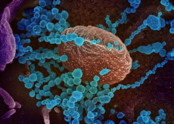 Here are 7 science-based strategies to help deal with coronavirus anxiety