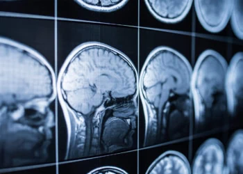 Children from poor neighborhoods show abnormal activation of motivational neurocircuits