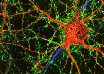Researchers zero-in on astrocytes as a mediator of the beneficial link between exercise and Alzheimer’s disease