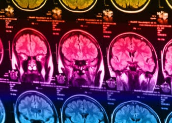 Faith and gray matter: New study finds no relationship between brain structure and religiosity