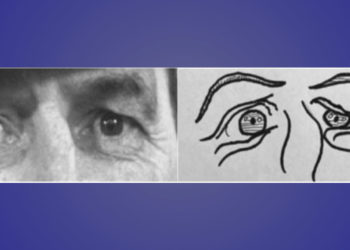 Autistic people outperform neurotypicals in a cartoon version of an emotion recognition task