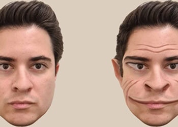 Insights into prosopometamorphopsia: When faces warp into nightmares