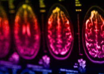 New study connects Mediterranean diet to positive brain chemistry