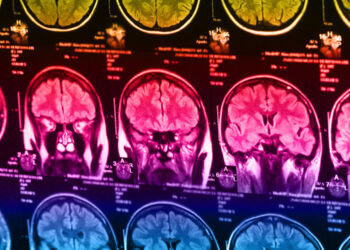 Six distinct biotypes of depression identified by scientists
