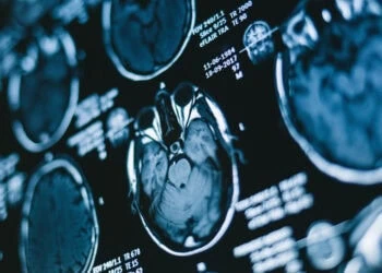 Dartmouth researchers create new template of the human brain