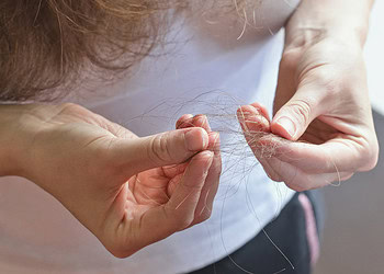 Better pre-treatment response inhibition predicts positive treatment outcomes in trichotillomania