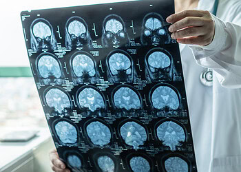 Even in healthy adults, high blood sugar levels are linked to impaired brain function