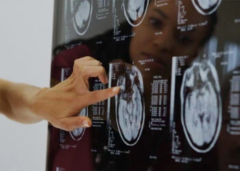 Parent’s anxiety sensitivity linked to teen’s brain patterns during emotional challenges