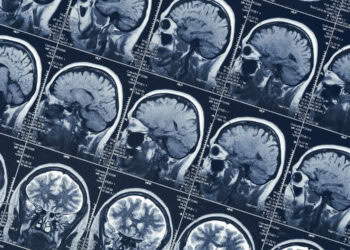 A surprising body part might provide key insights into schizophrenia risk