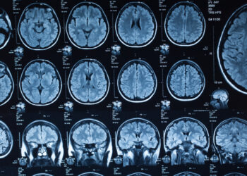 Brain scan MRI images showing detailed views of brain structures for neurological and psychological research.