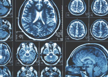 Brain scan MRI images of human brain in blue color.