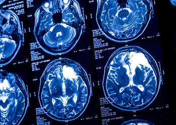 In shock discovery, scientists link mother’s childhood trauma to specific molecules in her breast milk