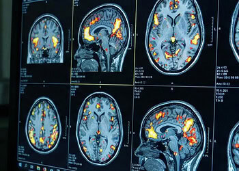 One specific reason for having sex is associated with higher stress levels the next day