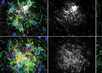 A common enzyme linked to diabetes may offer a new path for treating Alzheimer’s