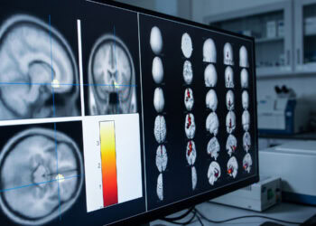 Negative social media posts correlated with changes in the brain’s fear network during the COVID-19 lockdown