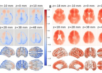 The right side of the brain shows more signs of aging than the left, new study suggests