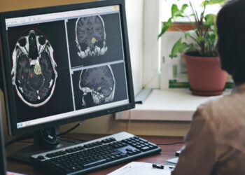 Brain scans suggest first graders don’t engage their control networks like adults when talking to ChatGPT