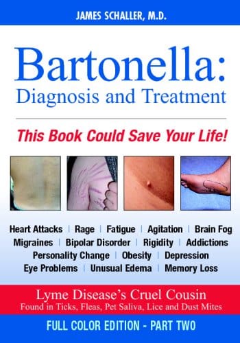 Bartonella: Diagnosis and Treatment: Part 2 of 2, Full Color Edition (Chuvash Edition)