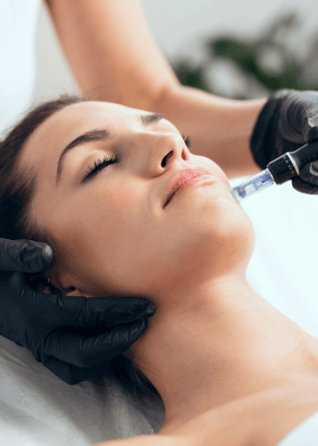 sesion-mesoterapia-granada