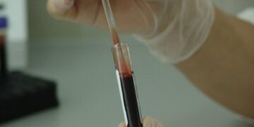 VIH Sida - crainte d'un relance de l' épidémie