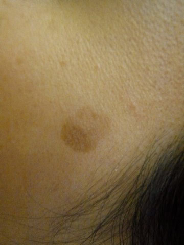 One of my flaws. Ehem, Facial not personality flaw. 