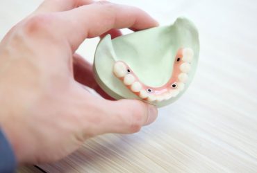 Dentisterie préventive