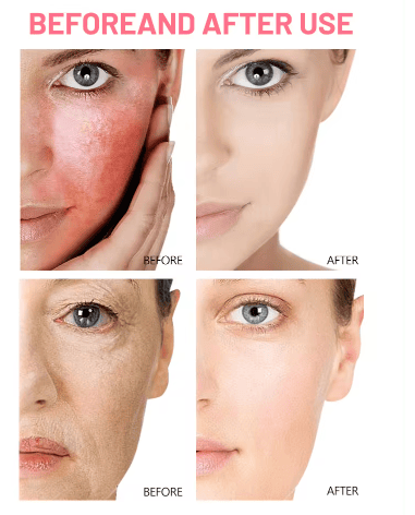 SERUM DE ROSAS CON ACIDO HIALURONICO - Imagen 4