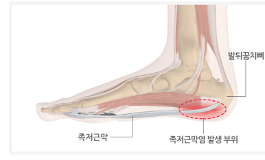 경안동필라테스 추천